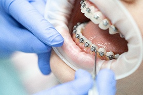 Closeup of patient filling out dental insurance paperwork