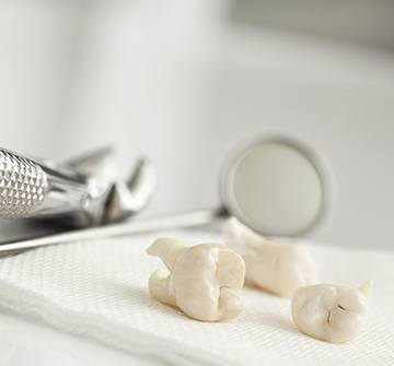 Three extracted teeth on a tray