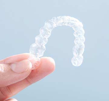 Closeup of Invisalign in Clinton