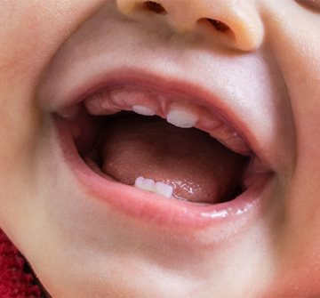 Closeup of baby teething in Clinton